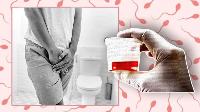 প্রস্রাবের সঙ্গে শ্বেতস্রাব?—কিডনি বিকল হওয়ার লক্ষণ নয় তো?
